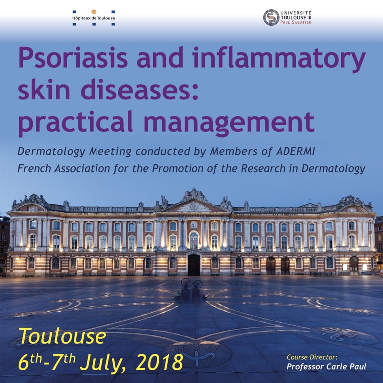 Psoriasis and inflammatory skin disease: practical management